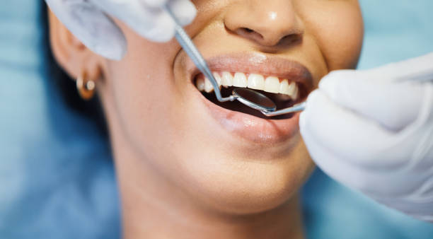Best Emergency Denture Repair in Osceola, MO