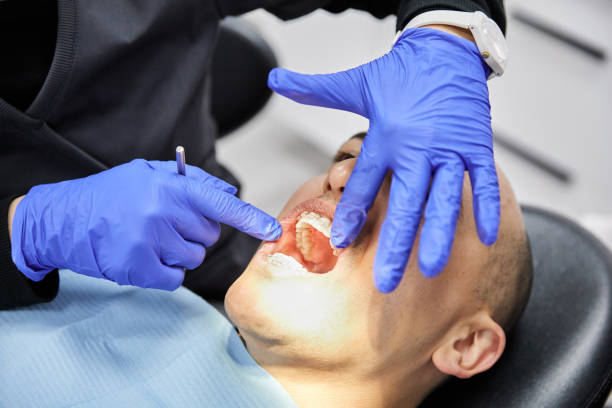 Best Emergency Treatment for Dental Infections or Abscesses in Osceola, MO