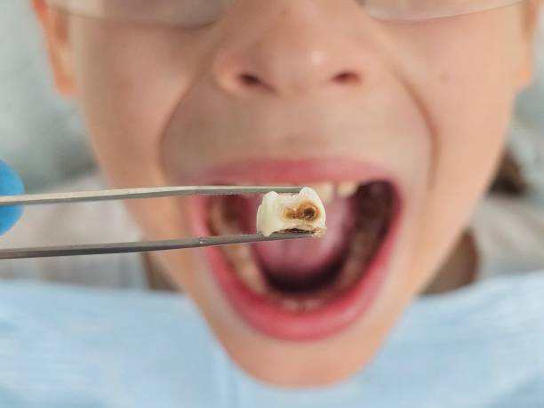 Best Weekend Emergency Dentist in Osceola, MO